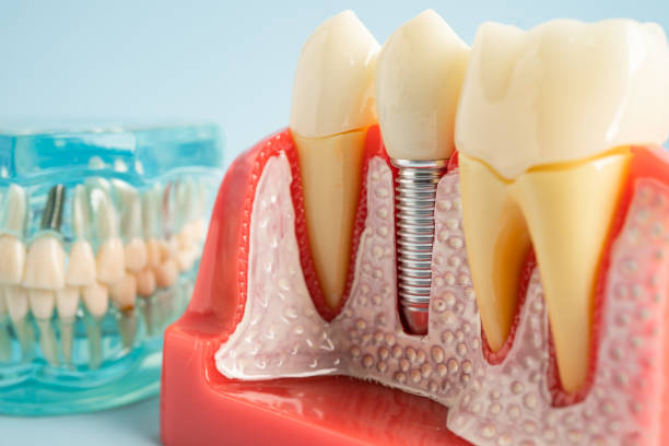 Best Dental Studio in Viera West, FL